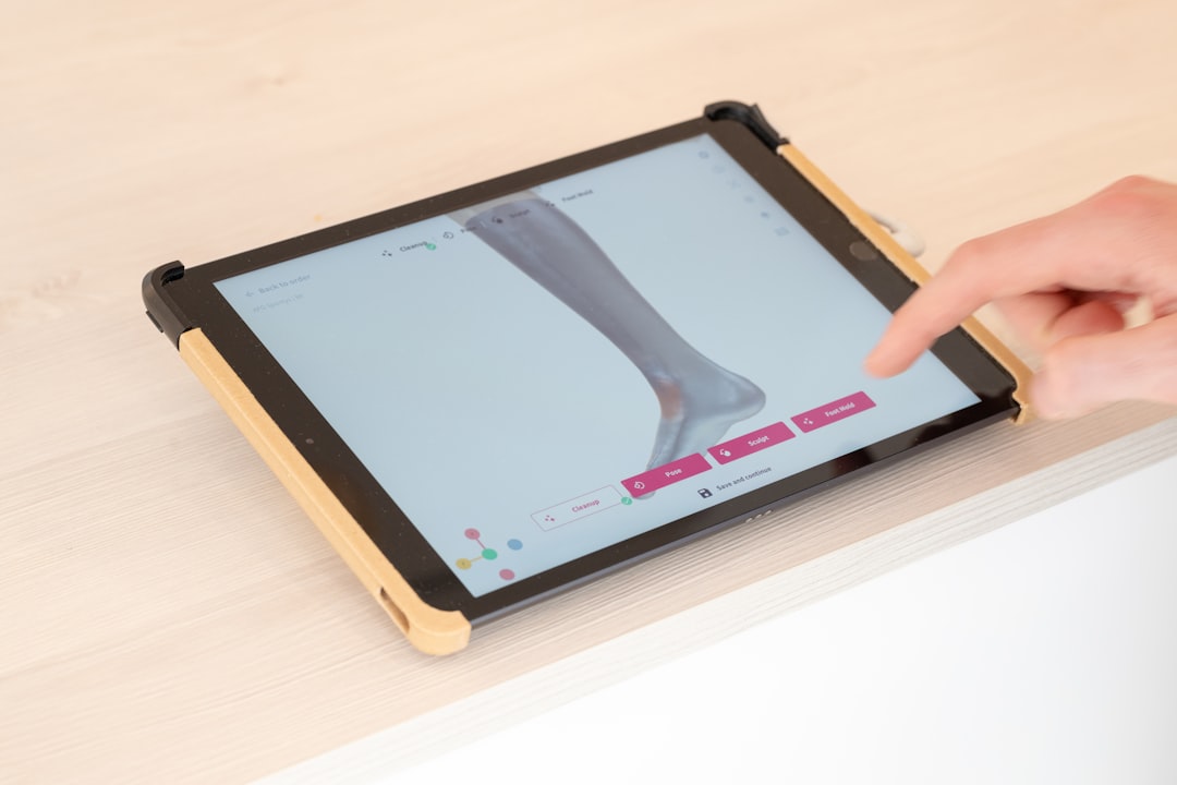 Focus on innovation – a glimpse into the digital crafting of orthotic devices, where technology meets patient-specific care on a digital platform.